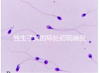 獨生子女的壞處初現(xiàn)端倪，贍養(yǎng)父母已成難題