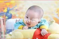 痤瘡的癥狀（痤瘡的癥狀表現有哪些）