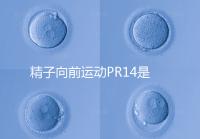 精子向前運動PR14是否正常聽專家怎么說，當心弱精找上門