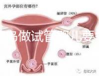 去青島做試管嬰兒要多少錢？