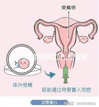 廈門哪里能做二代試管嬰兒，做一次成功率和費用多少？