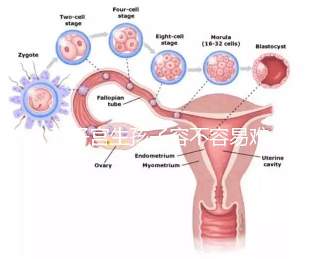 雙子宮生孩子容不容易難產看情況，注意這幾點也能順利抱娃