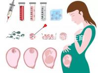 辦準(zhǔn)生證沒必要隱瞞生育史，女方再婚需帶離婚證