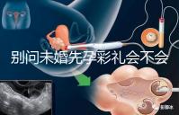 別問未婚先孕彩禮會(huì)不會(huì)少了，一分不給也不無可能