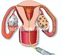 別還不造內膜10mm鮮胚容不容易著床，能否移植看這幾點