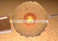 哈爾濱所有能做精子檢查的醫院都在這里，價格便宜又專業