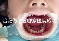 合肥做試管哪家醫(yī)院成功率最高（合肥做試管哪家醫(yī)院成功率最高的）