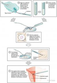 國內(nèi)首起試管嬰兒案例，法律竟難以給患者維權(quán)