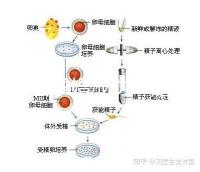 何猷君求婚成功！賭王四太回應“奚夢瑤懷孕”傳聞