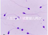 人在孕途！試管嬰兒兩次胎停育,了解這幾招能降低流產風險