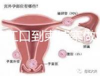 從丹江口到柬埔寨做第三代試管嬰兒怎么樣？要花多少錢(qián)？