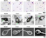 為何試管嬰兒都不順產(chǎn)（為何試管嬰兒都不順產(chǎn)呢）