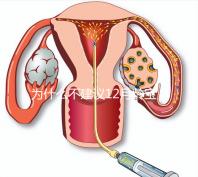 為什么不建議12月齡寶寶打水痘疫苗，醫生道出其中端倪
