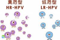 不孕不育怎樣治療效果好