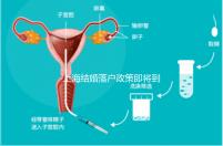 上海結(jié)婚落戶政策即將到來(lái)，包括2024年黃浦區(qū)詳細(xì)的戶籍流程