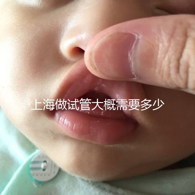 上海做試管大概需要多少費(fèi)用