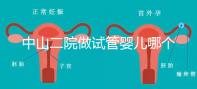 中山二院做試管嬰兒哪個醫生好？附醫院試管成功率