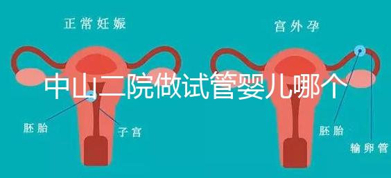 中山二院做試管嬰兒哪個醫生好？附醫院試管成功率