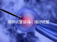 捐卵試管嬰兒（捐卵試管嬰兒費用）