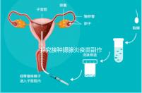 探究接種腮腺炎疫苗副作用，出現(xiàn)發(fā)燒用這3招應(yīng)對自如