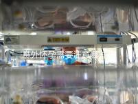 意外懷孕需要注意哪些事項(xiàng)？