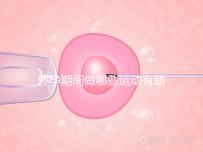 懷孕期間做哪些運動有助于自然分娩？