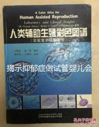 揭示抑郁癥做試管嬰兒會遺傳給女兒，想避免看這個