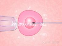 染色體XXY鬧?。嚎耸暇C合征，帶你走進“第三性別”群體