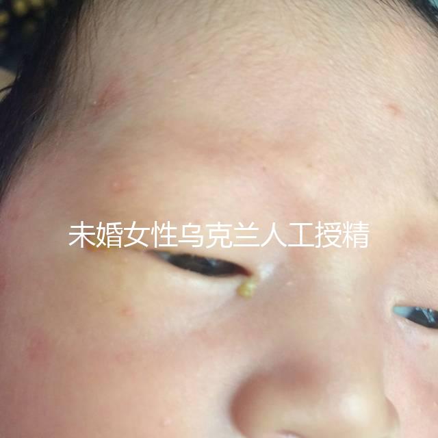 未婚女性烏克蘭人工授精必看！醫(yī)療及生活費用明細預覽