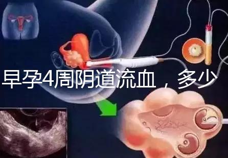 早孕4周陰道流血，多少天檢查血hcg或B超更穩(wěn)妥？