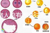 無痛人流有哪些注意事項(xiàng)？