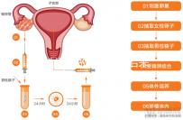 無(wú)性婚姻做試管嬰兒后來(lái)怎么樣？三個(gè)大案例揭開(kāi)了內(nèi)幕
