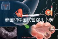 泰國和中國試管嬰兒（泰國和中國試管嬰兒技術(shù)差距）