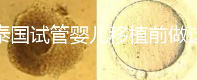 泰國試管嬰兒移植前做這3件事能提高成功率，不然會后悔！