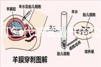 浙江三代試管最好的公立醫(yī)院推薦，參考性大隨你挑