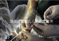 湯淼試管嬰兒（湯淼試管嬰兒是怎么來(lái)的）