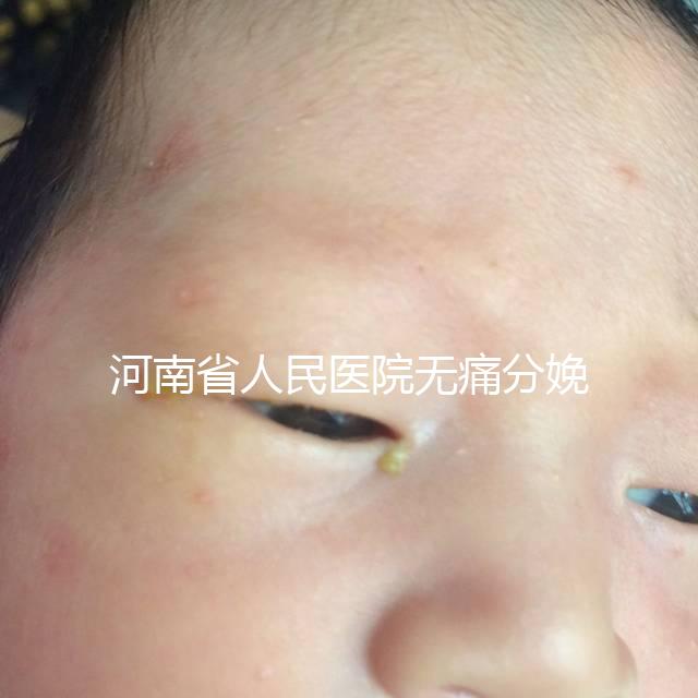 河南省人民醫院無痛分娩多少錢戳，收費標準60s看懂不踩坑