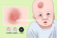 淄博男科醫院排名表來了2024年哪個口碑好？網友怎么說？