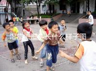 濕疹（濕疹長什么樣子圖片）