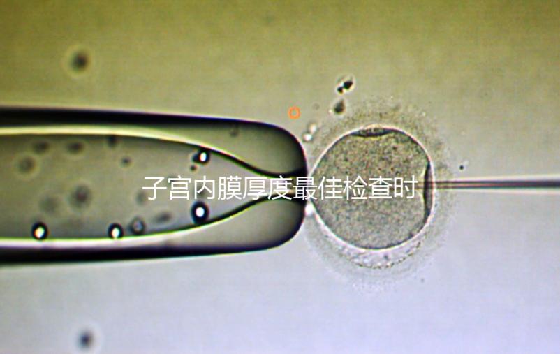 子宮內膜厚度最佳檢查時期，你有必要提前知道！