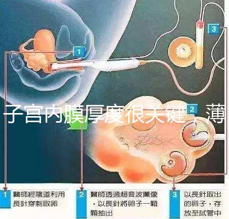 子宮內膜厚度很關鍵，薄了厚了試管嬰兒都難成功