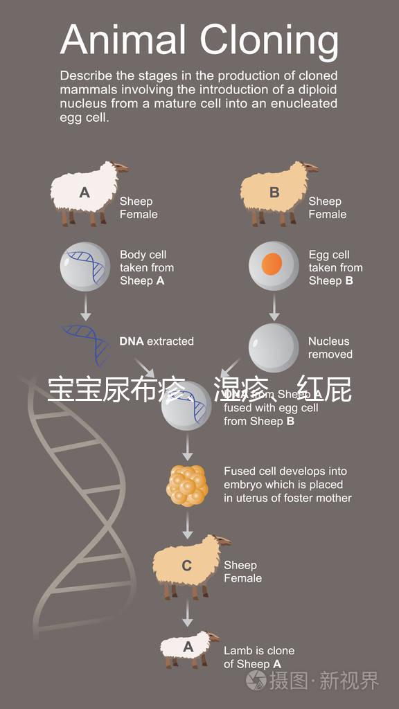 寶寶尿布疹、濕疹、紅屁股傻傻分不清？4點區別輕松診斷