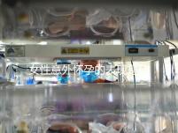 女性意外懷孕的表現是什么？