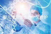 嬰兒濕疹怎么辦？艾葉護理不一定管用，4個小妙招輕松治療