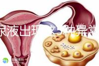 當尿液出現(xiàn)這5種異常情況，那么腎功能檢查刻不容緩