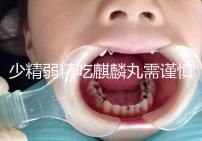 少精弱精吃麒麟丸需謹(jǐn)慎!千萬(wàn)別忽視這4大副作用