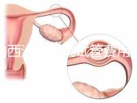 山西汾陽醫(yī)院試管費(fèi)用清單公布，2024年生殖科助孕成功率公布