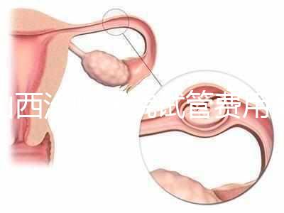 山西汾陽醫(yī)院試管費(fèi)用清單公布,2024年生殖科助孕成功率公布