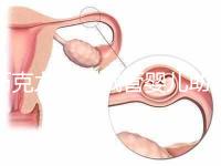 巧克力囊腫試管嬰兒助孕應(yīng)先治療？網(wǎng)友看法均有差異