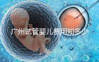 廣州試管嬰兒費用知多少？2025年廣州試管全過程費用與流程清單